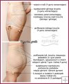 Figurina Girdle Pastel